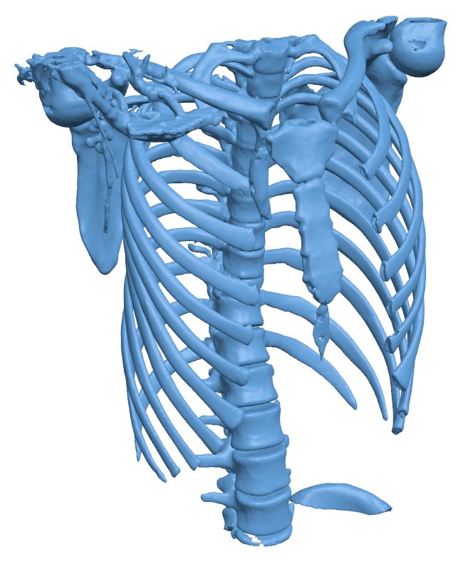 Spine with a T10 chance fracture – 3D Model – Vector files